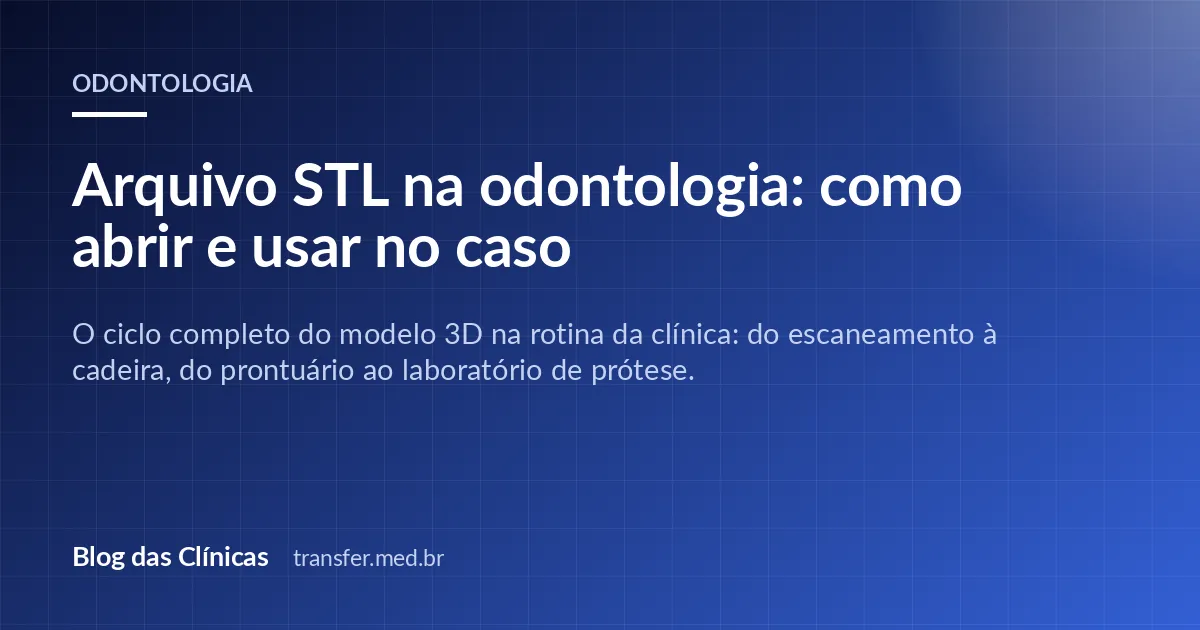 Arquivo STL na odontologia: como abrir e usar no caso