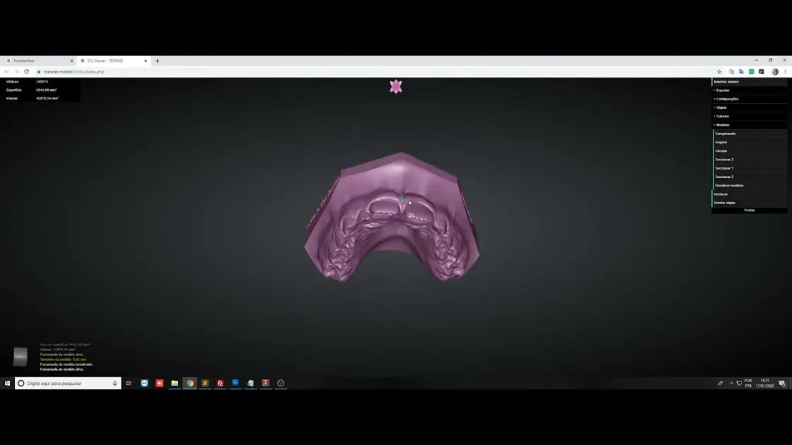 Prévia do vídeo do visualizador de modelos 3D em STL do Transfermed